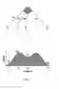 Fig. 07 - Methods and Systems for Determining Abnormal Cardiac Activity