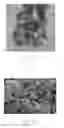 Fig. 07 - Glucose sensor apparatus addressing interference of ascorbic acid and acetaminophen
