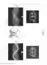 Fig. 07 - Deep learning based estimation of data for use in tomographic reconstruction