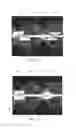 Fig. 09 - Deep learning based estimation of data for use in tomographic reconstruction