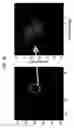 Fig. 11 - Deep tissue super-resolution ultrasound imaging method and system