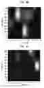 Fig. 12 - Deep tissue super-resolution ultrasound imaging method and system