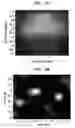 Fig. 13 - Deep tissue super-resolution ultrasound imaging method and system
