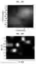 Fig. 14 - Deep tissue super-resolution ultrasound imaging method and system