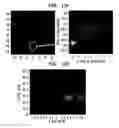Fig. 15 - Deep tissue super-resolution ultrasound imaging method and system