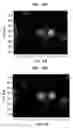 Fig. 16 - Deep tissue super-resolution ultrasound imaging method and system
