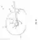 Fig. 02 - CRANIAL RECESS TOOL