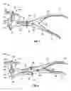 Fig. 02 - Bone mill having grinding surfaces provided with anti-binding dead-stops