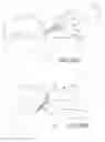Fig. 49 - Vertebral joint implants and delivery tools