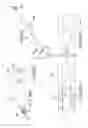 Fig. 85 - Vertebral joint implants and delivery tools