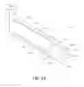 Fig. 12 - Arthroscopic devices and methods