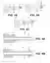 Fig. 04 - MULTIFUNCTIONAL ELECTROSURGICAL INSTRUMENTS WITH DYNAMIC ELECTRODE ASSEMBLIES