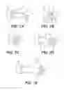 Fig. 06 - MULTIFUNCTIONAL ELECTROSURGICAL INSTRUMENTS WITH DYNAMIC ELECTRODE ASSEMBLIES