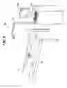 Fig. 02 - Surgery assistance system