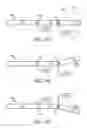 Fig. 06 - STEERABLE INTRODUCER FOR MINIMALLY INVASIVE SURGERY