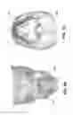 Fig. 07 - Reconstruction of a virtual computed-tomography volume to track orthodontics treatment evolution