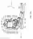 Fig. 40 - Implementing a stand-up sequence using a lower-extremity prosthesis or orthosis