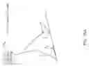 Fig. 64 - Implementing a stand-up sequence using a lower-extremity prosthesis or orthosis