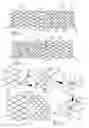 Fig. 02 - Hybrid stent and delivery system