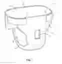 Fig. 02 - Surgical infant diaper