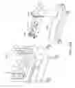 Fig. 31 - Devices and methods for a neonate incubator, capsule and cart