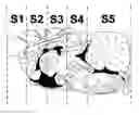 Fig. 01 - Slow intraventricular delivery
