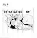 Fig. 02 - Slow intraventricular delivery