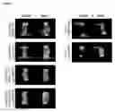 Fig. 06 - MESENCHYMAL STEM CELL-DERIVED EXTRACELLULAR VESICLES AND THEIR MEDICAL USE