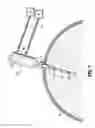 Fig. 08 - Air purifier for laparoscopic surgery