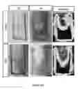Fig. 49 - Interpenetrating microstructures for nanochannel-based cargo delivery