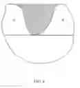 Fig. 05 - Radiation method and apparatus for radiating a fluence map having zero fluence region