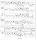Fig. 46 - Conjugates of cell binding molecules with cytotoxic agents