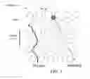 Fig. 02 - Phosphoprotein detection using a chip-based pillar array