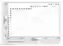 Fig. 01 - In vitro method for identifying a pregnancy related disease