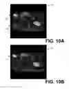 Fig. 09 - Method and systems for reducing artifacts in magnetic resonance imaging