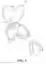 Fig. 02 - INTRAORAL DEVICE HOLDER