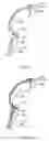 Fig. 08 - Acoustic string instrument, and methods for manufacturing and repairing same