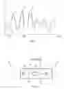 Fig. 04 - Method for reducing noise in an audio signal and a hearing device