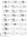 Fig. 05 - Methods, systems and processes of identifying genetic variation in highly similar genes