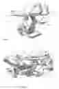 Fig. 02 - Surgical teleoperated device for remote manipulation