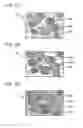 Fig. 03 - Powder core, electric or electronic component including the powder core and electric or electronic device having the electric or electronic component mounted therein