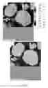 Fig. 09 - Anode material, method for making the same, and lithium-ion battery