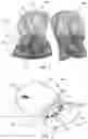 Fig. 02 - Protective hand covering for infants