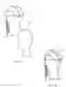 Fig. 07 - Wig-management template-shield system and method