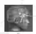Fig. 02 - Helmet with shear force management