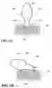 Fig. 07 - SYMMETRIC-MULTI-FUNCTION-CONCAVE-OPERATING-EDGE SYMMETRIC-MULTI-FUNCTION-OPERATING-TIP ARTIFICIAL NAIL, HAVING SYMMETRIC-CONVEX-BASE-EDGE SYSTEM, SYMMETRIC-CONCAVE-EXTENSION-EDGE SYSTEM, SYMMETRIC-DIGITAL-ICON-AND-KEYBOARD-OPERATING-TIP SYSTEM, AND SYMMETRIC-MINI-KEYBOARD-OPERATING-TIP SYSTEM