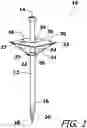 Fig. 02 - Folding Table Platform for Use on a Vertical Shaft or Pole