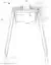 Fig. 01 - Lower Extremity Dressing Aid