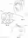 Fig. 11 - Hand cleaning device