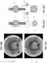 Fig. 22 - Method and apparatus for manipulating the side wall of a body lumen or body cavity so as to provide increased visualization of the same and/or increased access to the same, and/or for stabilizing instruments relative to the same
